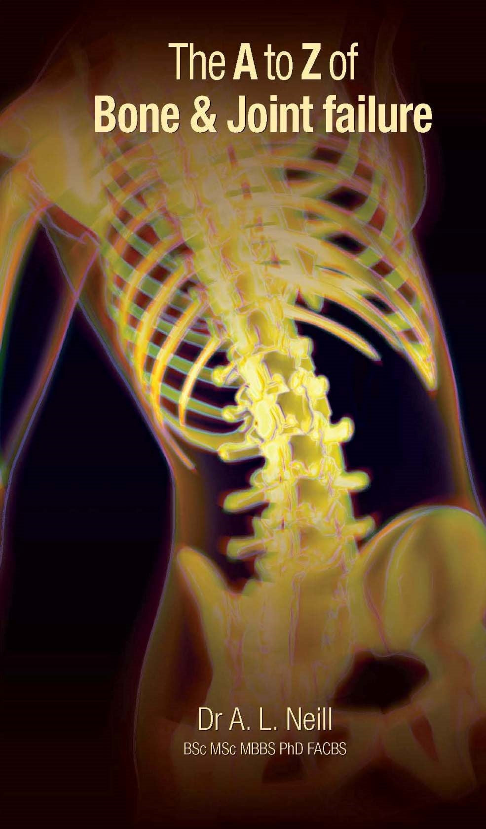 The A to Z of Bone and Joint Failure by Amanda Neill