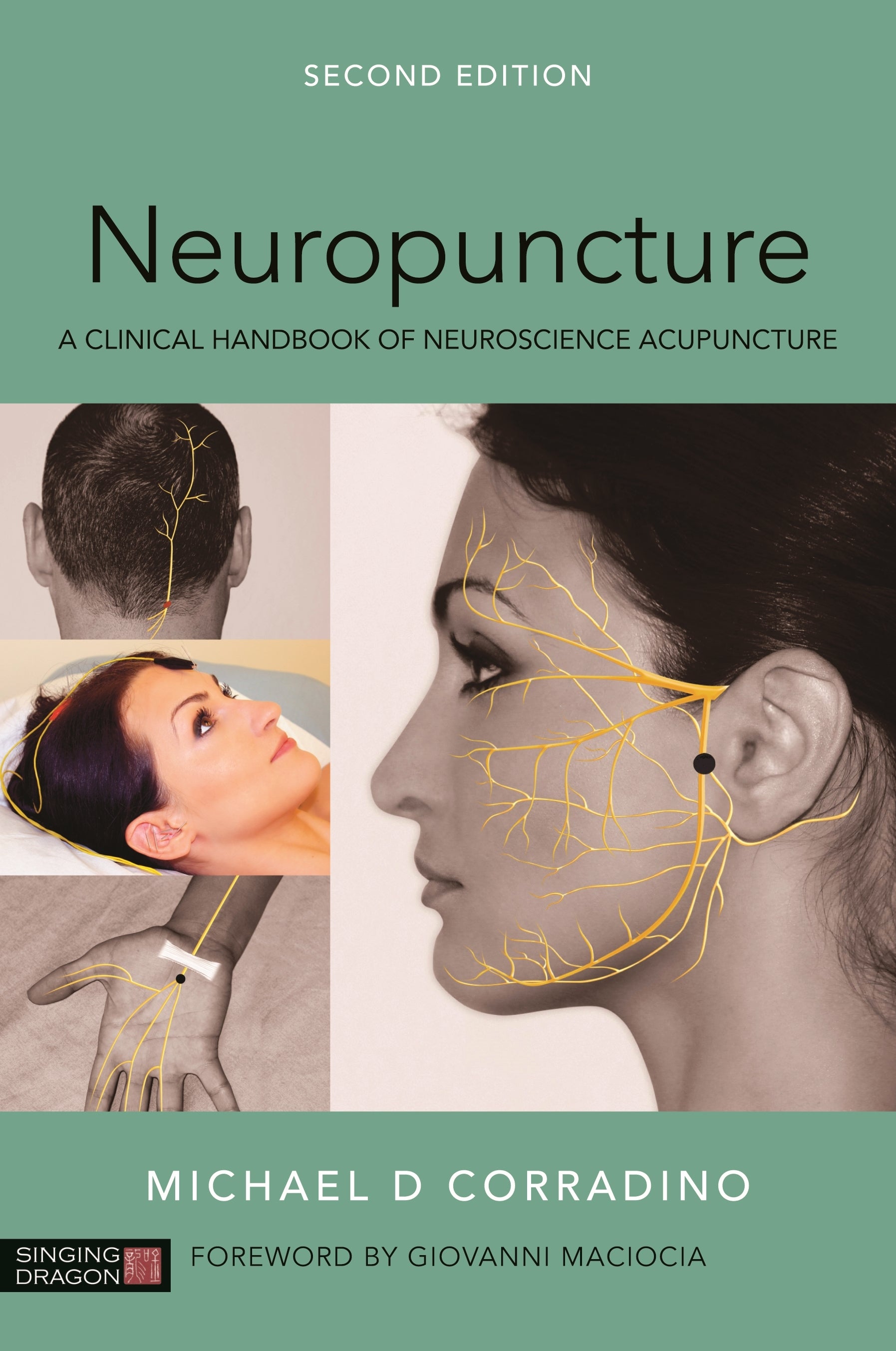 Neuropuncture by Michael Corradino, Giovanni Maciocia